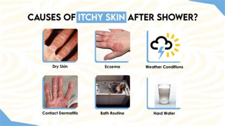 Why are my legs so itchy after a shower?