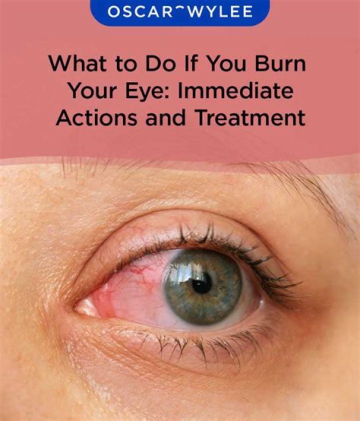 Why do my eyes burn after LASIK?