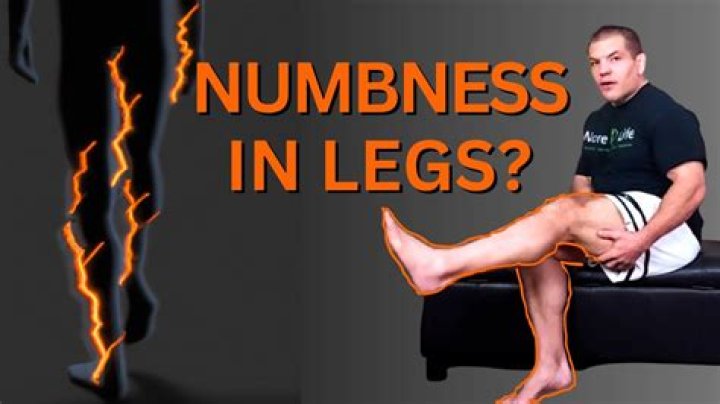 Why do my legs go numb when I exercise?