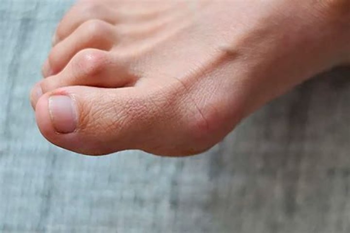 Why do my toes go numb when skiing?