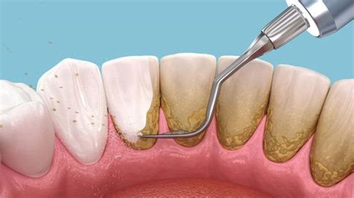 Why do teeth get dirty overnight?