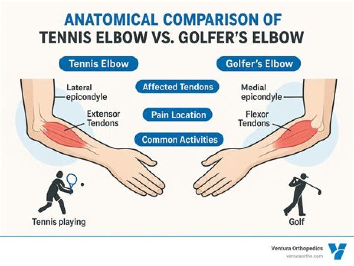 Why does tennis elbow hurt more at night?
