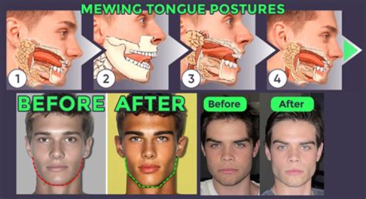 Why is my jaw so fat?